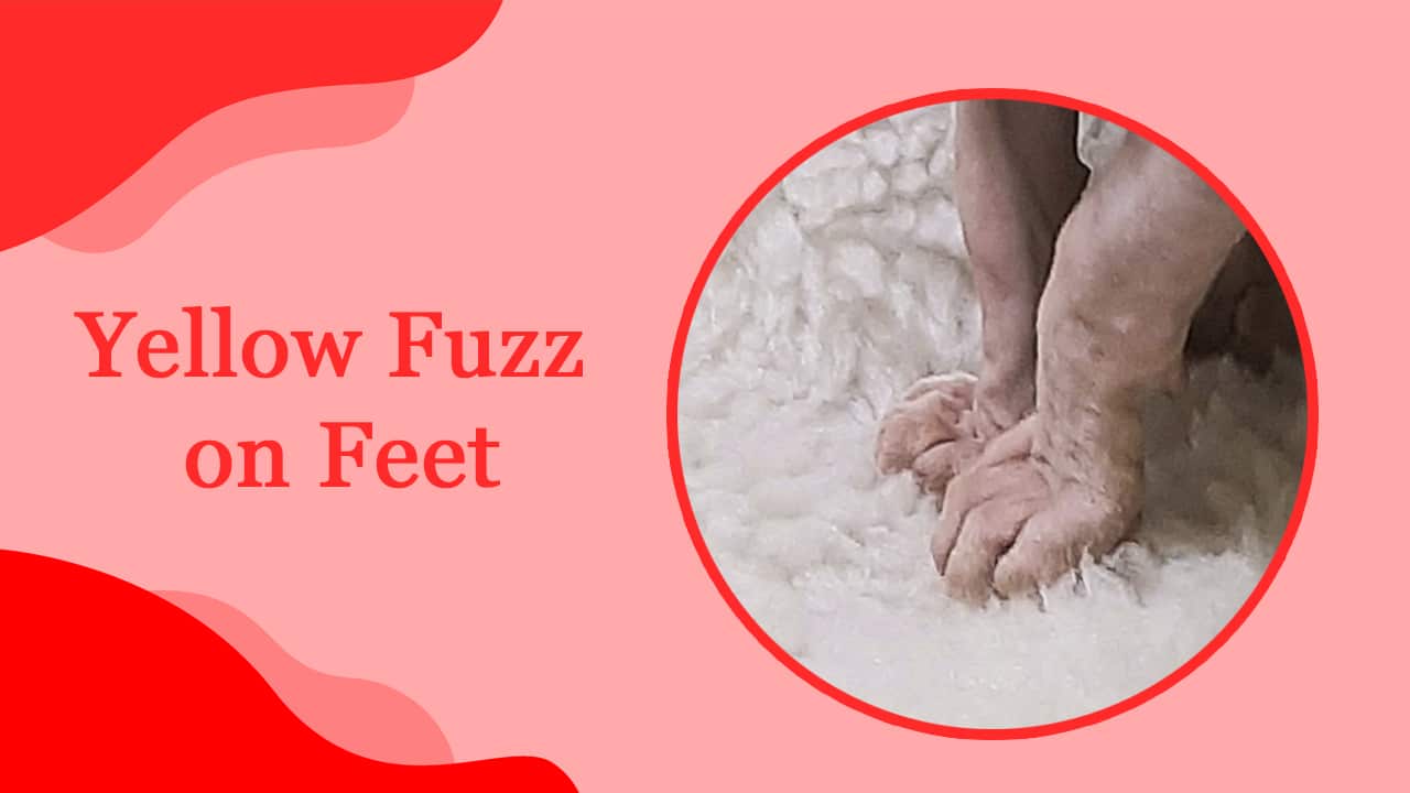 Sphynx Cat Questions and Answers – Yellow Fuzz on Feet